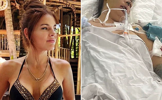 Plastika nosu ve Vietnamu se zvrtla, žena je v kómatu