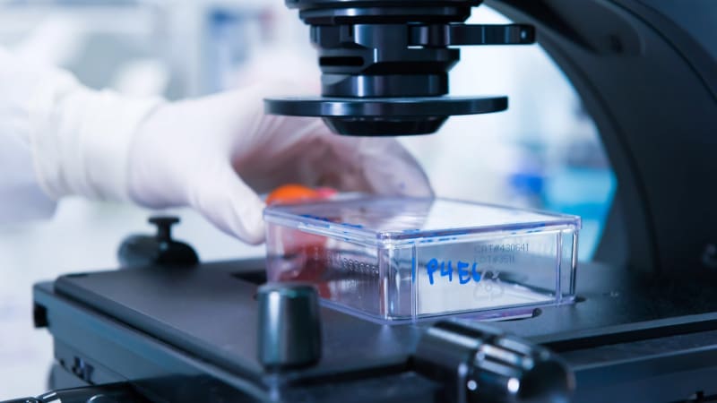 Mladých s rakovinou přibývá. Vědci tápou, co se změnilo, teď ale mají novou naději